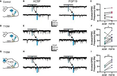 Fibroblast Growth Factor 19 Increases the Excitability of Pre-Motor Glutamatergic Dorsal Vagal Complex Neurons From Hyperglycemic Mice